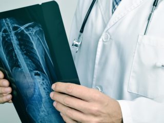 В травматологическом отделении Дербентской ЦГБ 9-летней девочке проведена сложнейшая операция на костях таза.